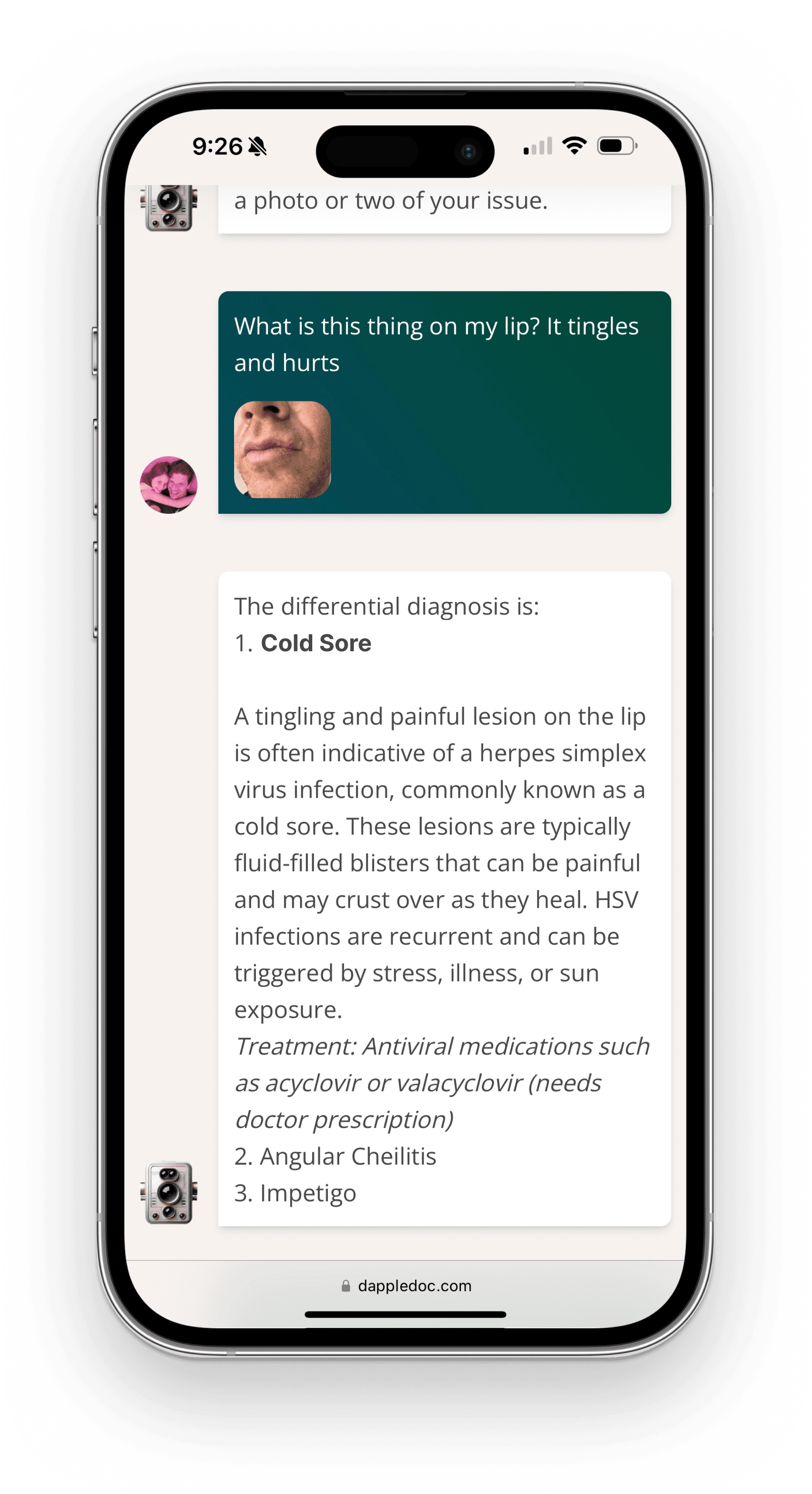 A smartphone screen displaying a text conversation about a tingling, painful lesion on the lip. The differential diagnosis is shown, listing cold sore, angular cheilitis, and impetigo as possibilities.